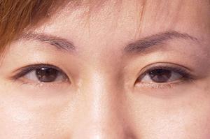 冷え性はサプリメントで改善が期待できる