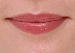 痛みの少ない安全な治療が受けられる